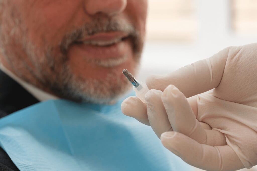 implantologia dentista padova